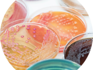 Petri dishes filled with specimens