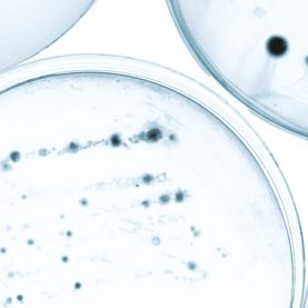 Organisms in petri dishes
