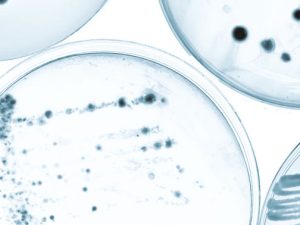 Organisms in petri dishes