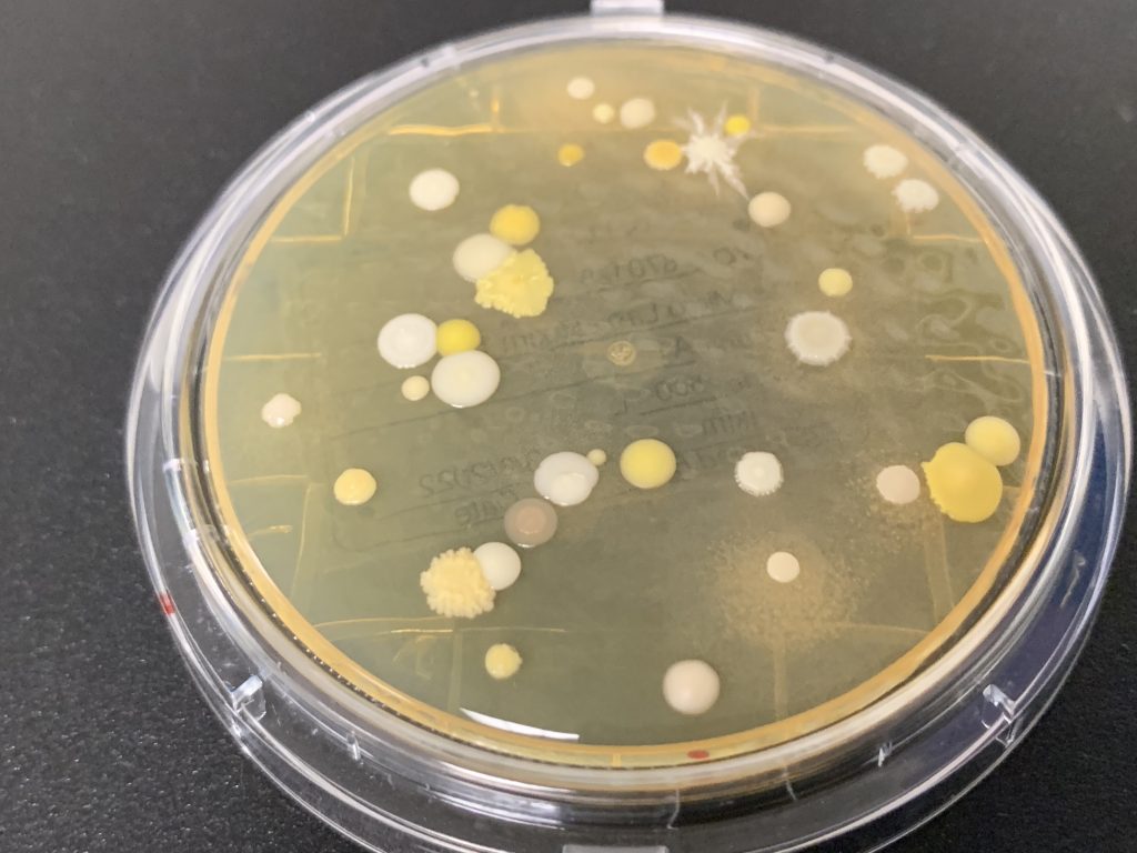 A petri dish with specimens